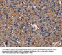 NCSTN Antibody