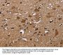 NCSTN Antibody