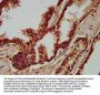 IGSF9 Antibody