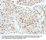 Rabbit anti-human HNF1B polyclonal antibody
