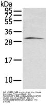 ZFAND2B Antibody