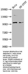 PDE6C Antibody