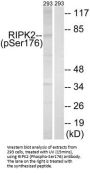 Phospho-RIPK2 (Ser176) Antibody