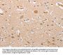 Rabbit anti-human CSGALNACT2 polyclonal antibody