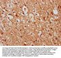 TMEM2 Antibody