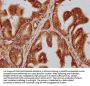 TTLL3 Antibody