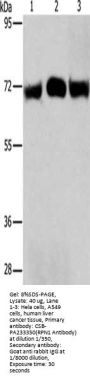 RPN1 Antibody