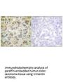 VIM Antibody