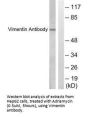 VIM Antibody