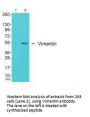 VIM Antibody
