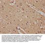 ATP2B4 Antibody