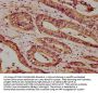 ATP2B4 Antibody