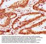 CABIN1 Antibody