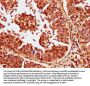 CABIN1 Antibody