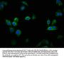 CACNA1D Antibody
