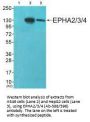 EPHA2/EPHA3/EPHA4 (Ab-588/596) Antibody
