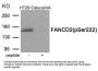 Phospho-FANCD2 (Ser222) Antibody