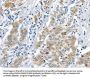 LRP6 Antibody