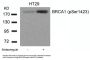 Phospho-BRCA1 (Ser1423) Antibody
