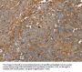 FAIM2 Antibody