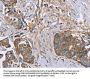FAIM2 Antibody