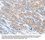 ADAM2 Antibody