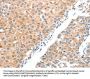 ADAM2 Antibody