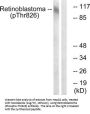 Phospho-RB1 (Thr826) Antibody