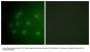 Phospho-RB1 (Thr826) Antibody