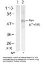 Phospho-MYC (Thr358) Antibody