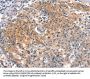 BFAR Antibody