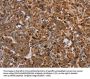 REG3A Antibody