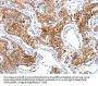 ADA Antibody