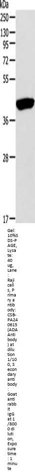 ADA Antibody