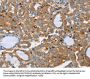 Rabbit anti-human PLS3 polyclonal antibody