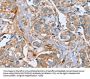 Rabbit anti-human PLS3 polyclonal antibody