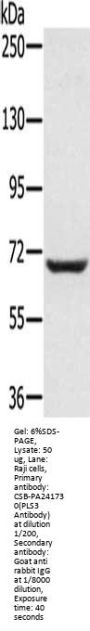 Rabbit anti-human PLS3 polyclonal antibody