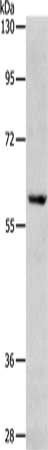 RPS6KB1 Antibody