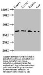fas Antibody