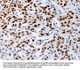 Rabbit anti-human MUTYH polyclonal antibody