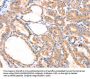 PRDX2 Antibody