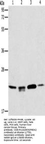 PRDX2 Antibody