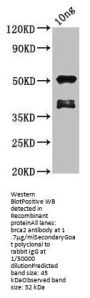 brca2 Antibody