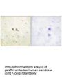 FASLG Antibody