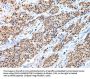 CTBP1 Antibody