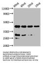 notchl Antibody
