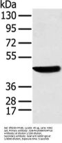 KRT18 Antibody