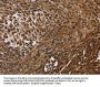 DCP1A Antibody