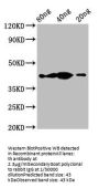 th Antibody