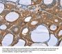 NOS2 Antibody